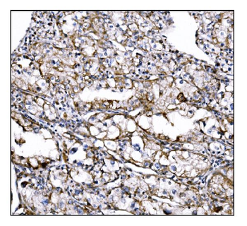 DLGAP1 Antibody
