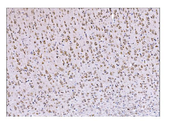DLGAP1 Antibody