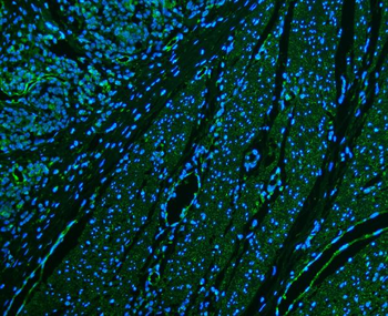 CD39/ENTPD1 Antibody