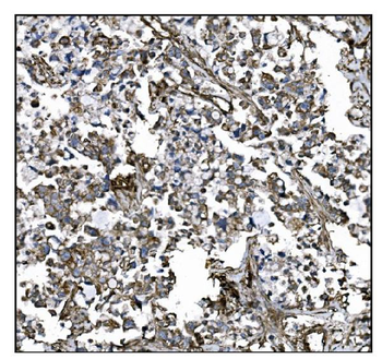 CD39/ENTPD1 Antibody