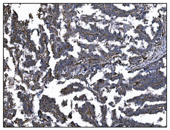 CD39/ENTPD1 Antibody