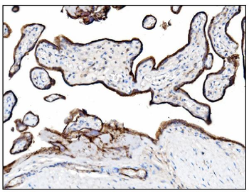 CD39/ENTPD1 Antibody