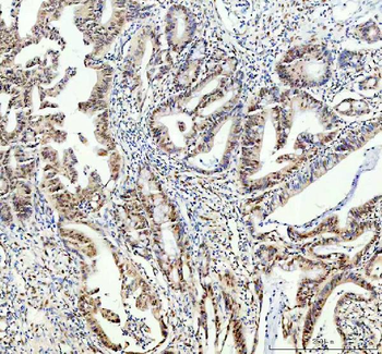 FTO Rabbit Polyclonal Antibody