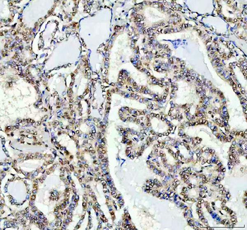 FTO Rabbit Polyclonal Antibody
