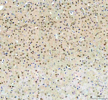 FTO Rabbit Polyclonal Antibody