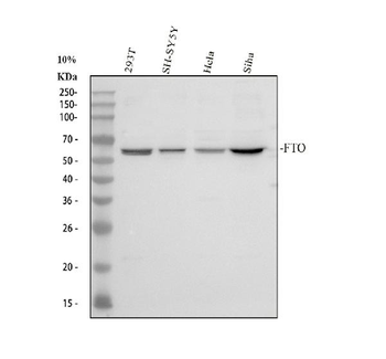 FTO Rabbit Polyclonal Antibody