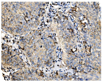 GOLPH2/GOLM1 Rabbit Polyclonal Antibody