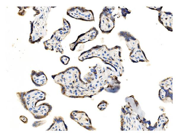 GOLPH2/GOLM1 Rabbit Polyclonal Antibody