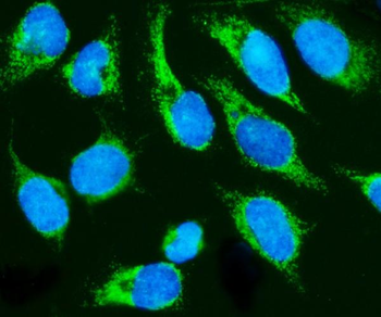 HCCS Antibody