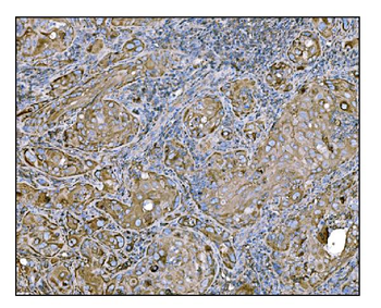 HCCS Antibody