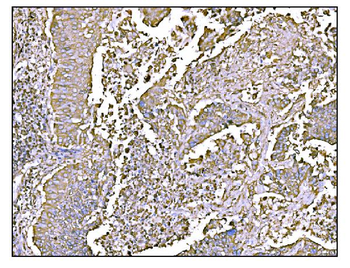 HCCS Antibody