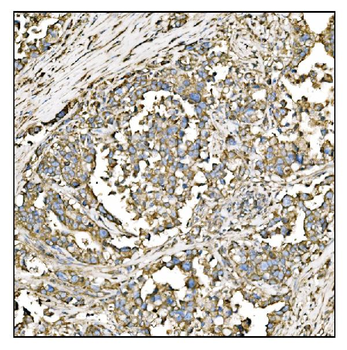 HCCS Antibody