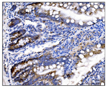 HCCS Antibody