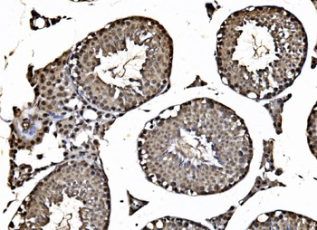 HDAC2 Antibody