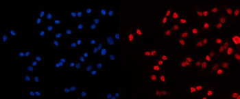 HDAC2 Antibody