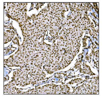 HDAC2 Antibody
