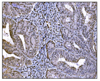 HDAC2 Antibody