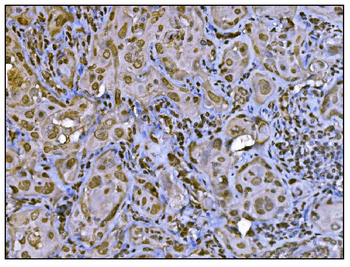 HDAC2 Antibody