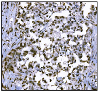 HDAC2 Antibody