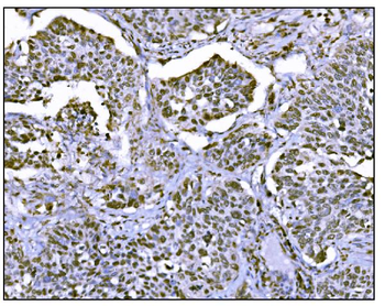 HDAC2 Antibody