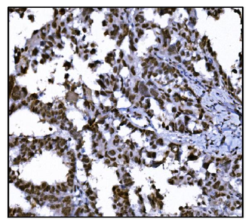 HDAC2 Antibody