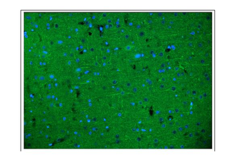 alpha Internexin/INA Rabbit Polyclonal Antibody