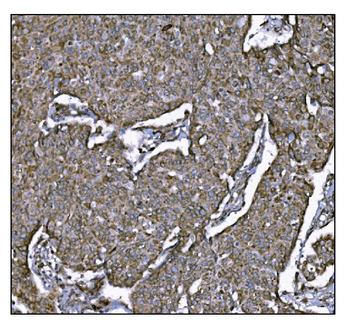LRP1B Antibody
