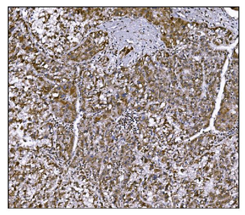 LRP1B Antibody