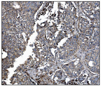 LRP1B Antibody