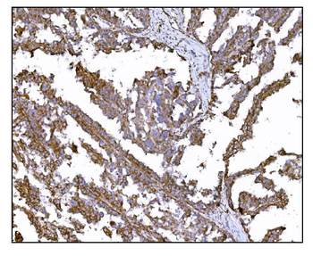 LRP1B Antibody