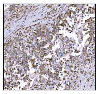 LRP1B Antibody