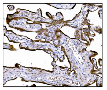 LRP1B Antibody