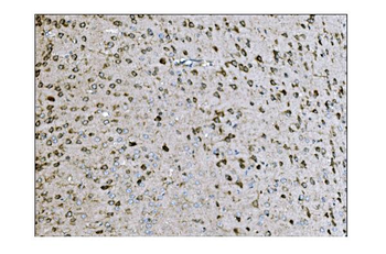 LRP1B Antibody