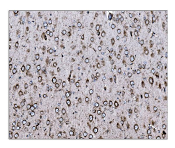 LRP1B Antibody