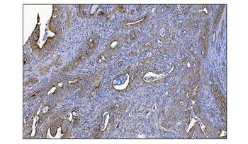 MERTK Antibody