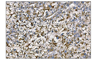 MERTK Antibody