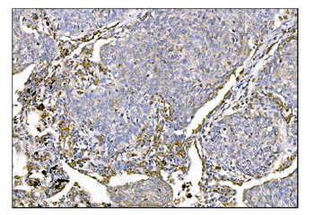MERTK Antibody
