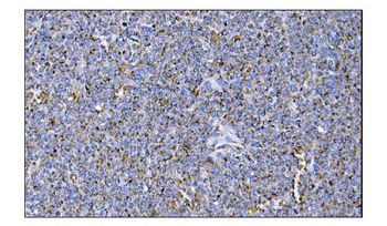 MERTK Antibody