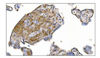 MERTK Antibody