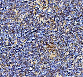 Ki67/Mki67 Antibody