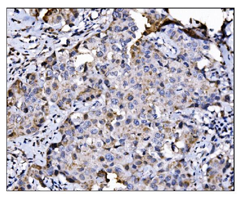 NDE1 Rabbit Polyclonal Antibody