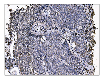 NDE1 Rabbit Polyclonal Antibody