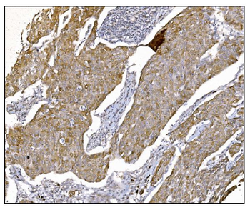 NDEL1 Antibody