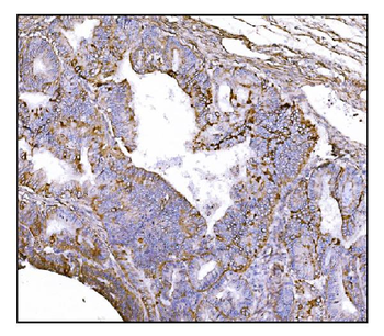 NDEL1 Antibody