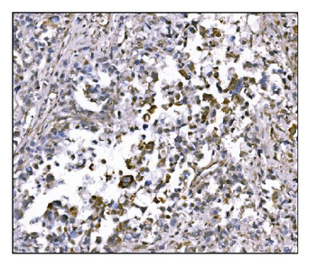 NDEL1 Antibody