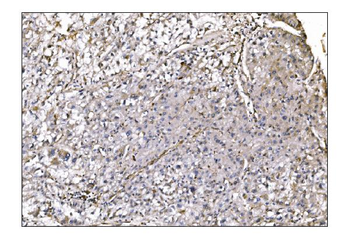 NDEL1 Antibody