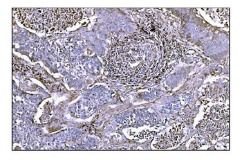 NDEL1 Antibody