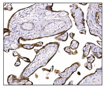 NDEL1 Antibody