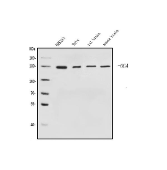 MGEA5/OGA Rabbit Polyclonal Antibody