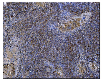 POGLUT1 Antibody